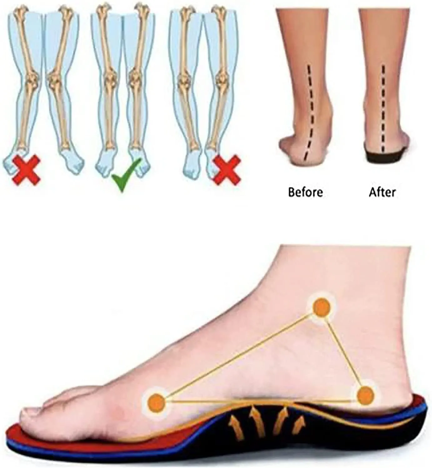 Orthopedic Sneakers for Women, 2023 Orthopedic Shoes for Women, Womens Orthopedic Shoes, Slip-On Light Air Cushion Orthopedic Sneakers